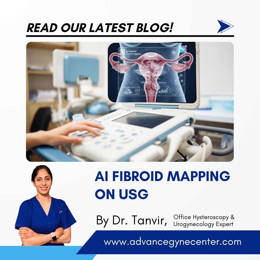 AI Fibroid Mapping on USG Advance Gynecology Center – Tanvir Hospital Hyderabad