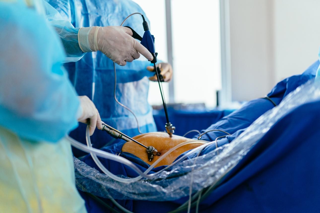 Endoscopic Surgery - laparoscopy